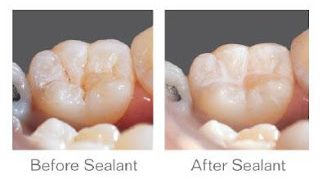 Sealants  La Grange, TX 